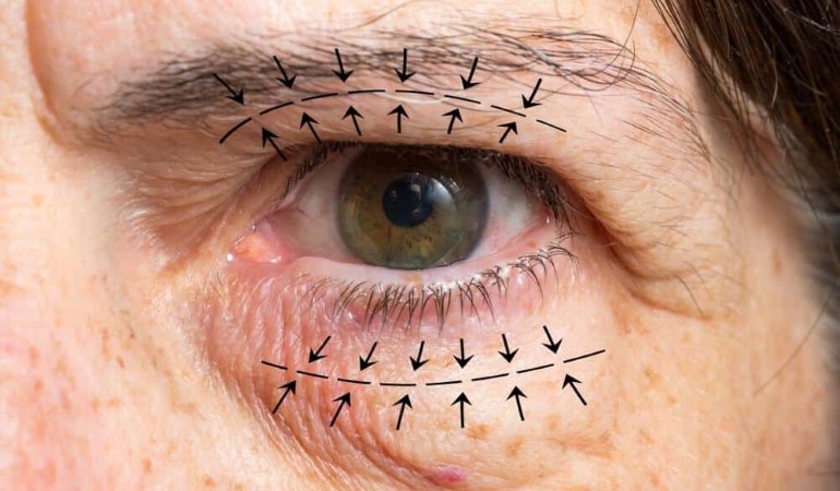 Oculoplastic & Reconstruction